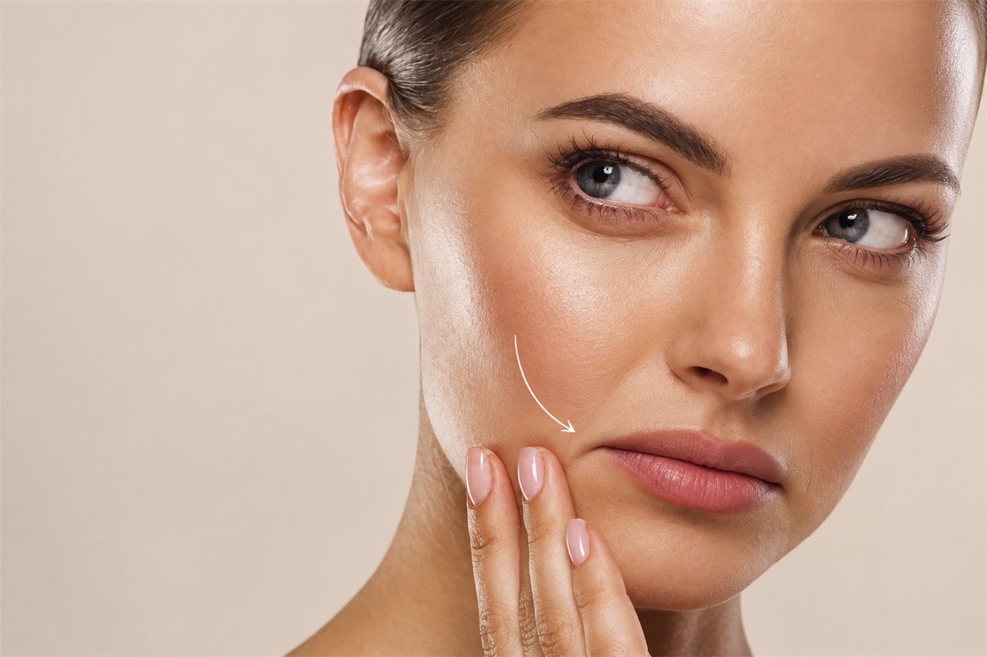 Marionette line and mouth corner treatment mapped out at a Putney clinic in London