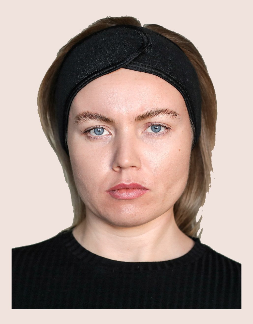 Nasolabial fold treatment softening nose to mouth lines in Putney, London