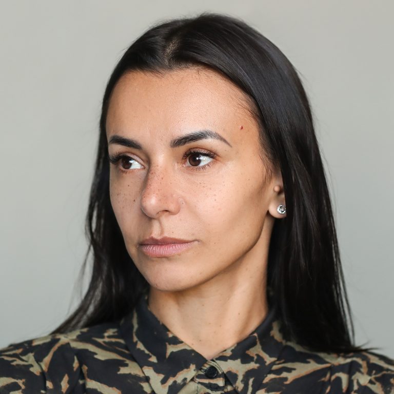 Chin and Jawline fillers